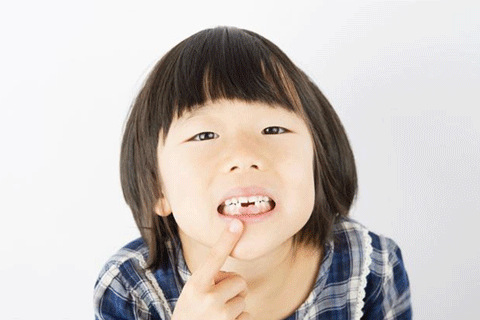 七五三の撮影前に歯が抜けたらどうする？